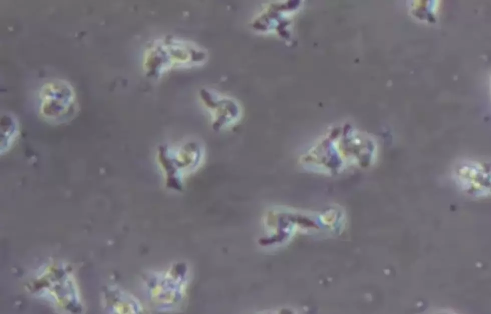 Missouri Swimmer Ends Up With Brain-Eating Amoeba from Iowa Lake